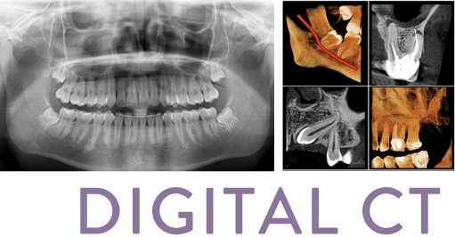 DIGITAL CT