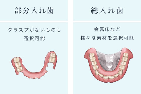 ＜部分入れ歯＞クラスプがないものも選択可能　＜総入れ歯＞金属床など様々な素材を選択可能