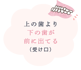 上の歯より下の歯が前に出てる（受け口）